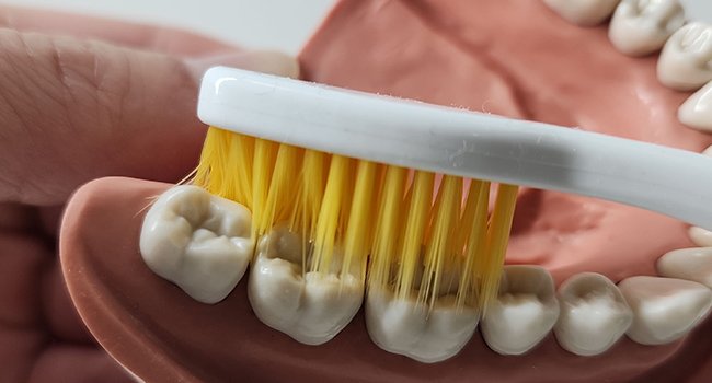 Dolphin Gold Toothbrush cleaning plaque along sensitive gum line